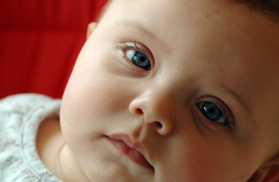 Синяки под глазами у ребенка: какие причины синевы, темных кругов у подростков, детей 2-8 лет, новорожденных