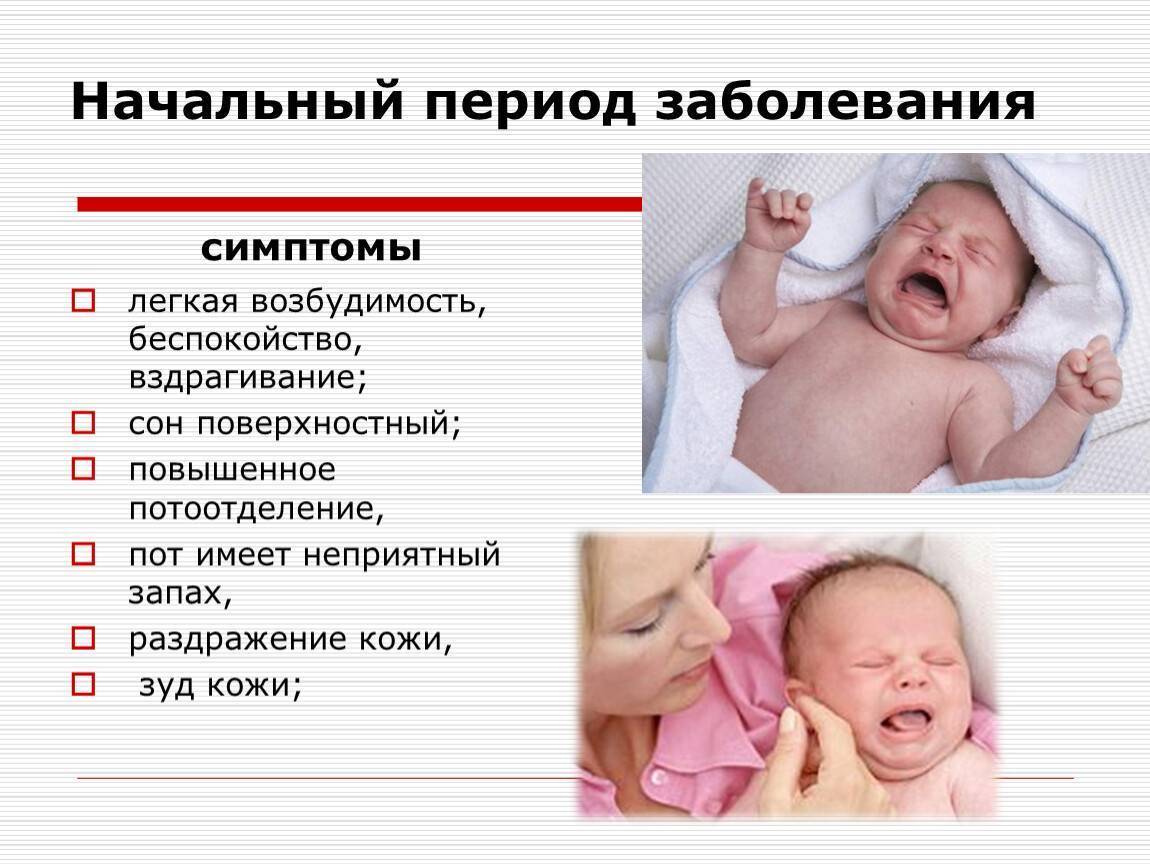 У ребенка пот пахнет. Начальный период заболевания. Холодный пот у грудничка. Периоды беспокойства у новорожденных. Повышенная возбудимость у новорожденного.