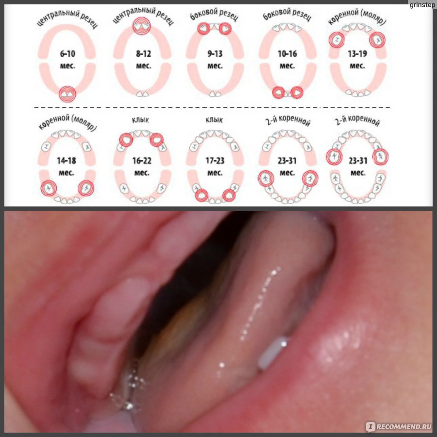 Скольки месяцев режутся зубы. Зубы у детей порядок прорезывания молочных. Прорезание верхних зубов. Процесс появления зубов.