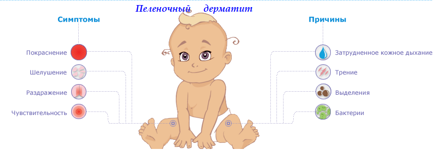 Аллергия на подгузники: как определить и как лечить?