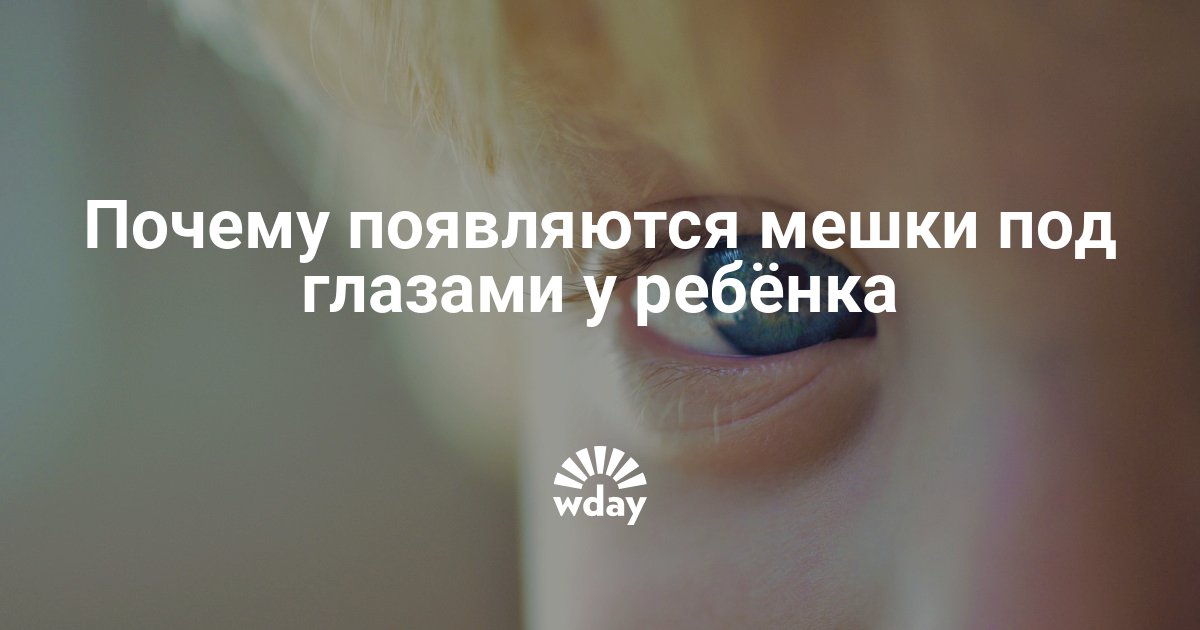 Мешки под глазами у ребенка — причины появления у младенцев