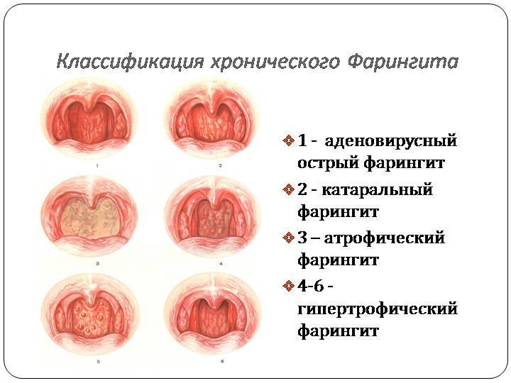 Красная сыпь на небе во рту у взрослых и детей, красные точки, пятна и высыпания в горле
