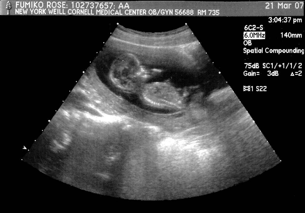 12 недель беременности: фото узи, что происходит, размер плода, пол ребенка