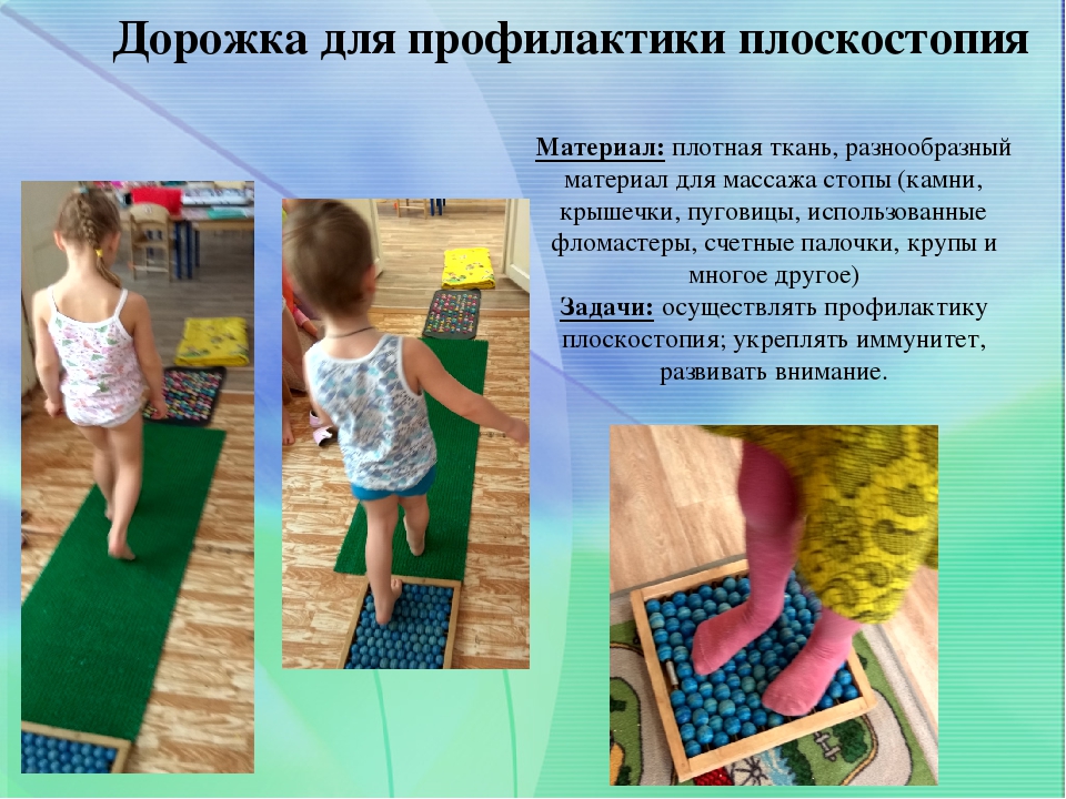 Предупреждение плоскостопия