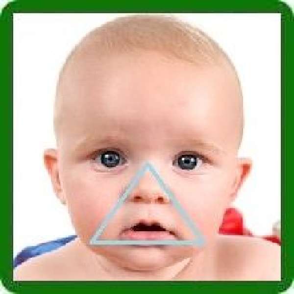 Цианоз носогубного треугольника, губ и носа у грудного ребенка
