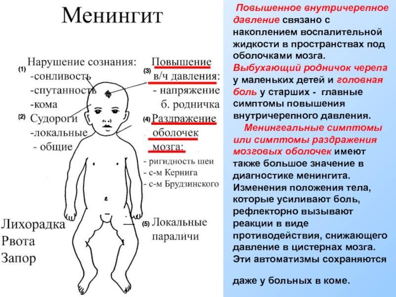Внутричерепная гипертензия у детей: 10 симптомов, причины, диагностика и лечение
