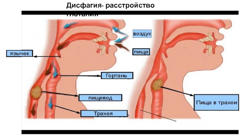 Как перестать сражаться с ребенком, который ничего не ест: советы родителям