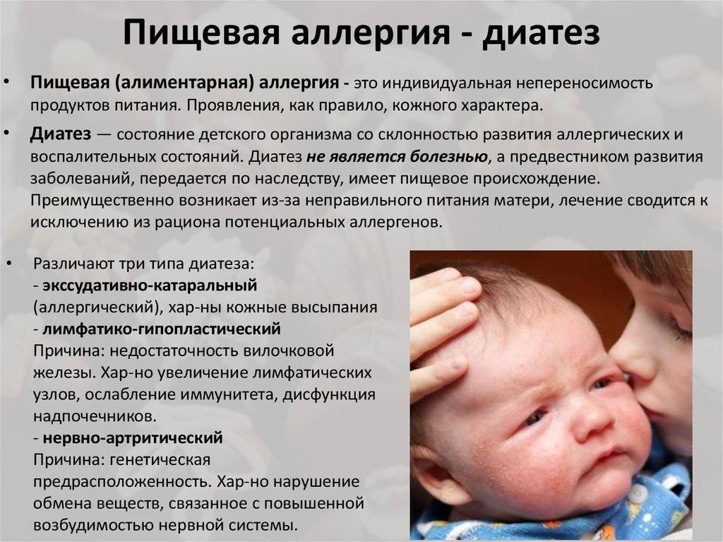 Диатез. причины и виды диатеза. симптомы и синдромы диатеза