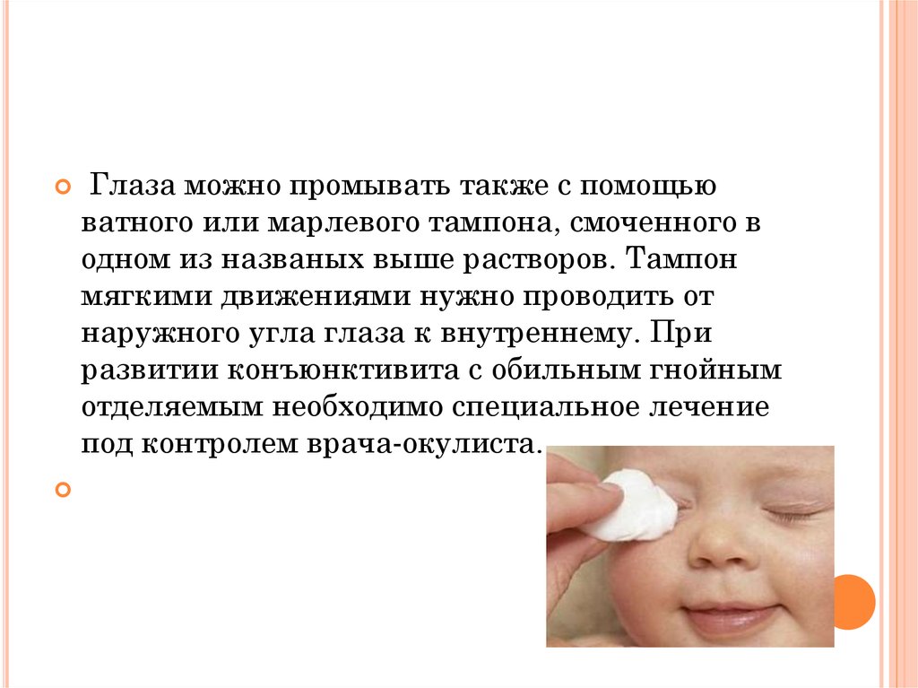 Чем обрабатывают глазки. Обработка глаз от наружного угла к внутреннему. Обработка глаз новорожденному проводится:. Промывка глаз от внутреннего угла к внешнему. Промывание глаз от внешнего к внутреннему.