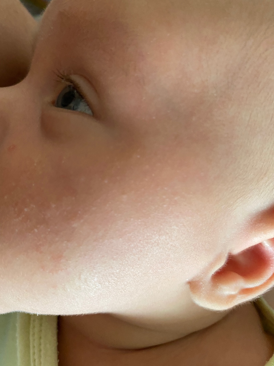 Виды сыпи на теле у ребенка — фото с описаниями и пояснениями: мелкая или красная, похожая на мурашки, с зудом и без