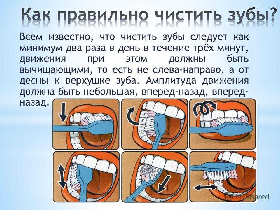Как правильно чистить зубы ребенку - underson clinic