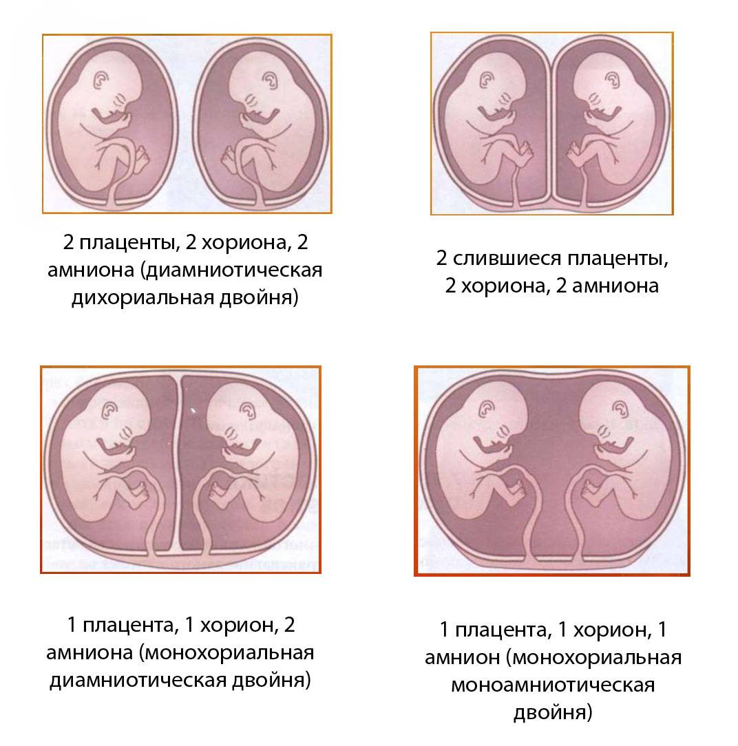 Многоплодная беременность — откуда берется и как протекает? | аборт в спб