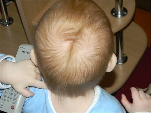 Если у малыша проблемы с волосами