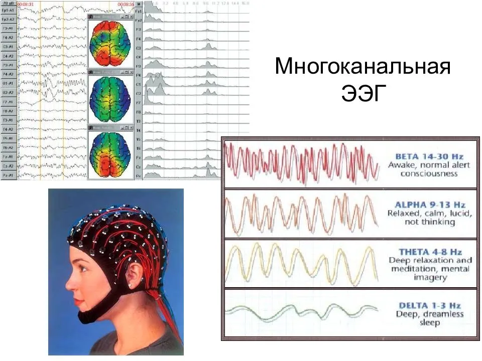 Делают ээг год. Электроэнцефалография головного мозга (ЭЭГ). ЭЭГ головного мозга пример. ЭЭГ головного мозга методика проведения. ЭЭГ норма и патология.