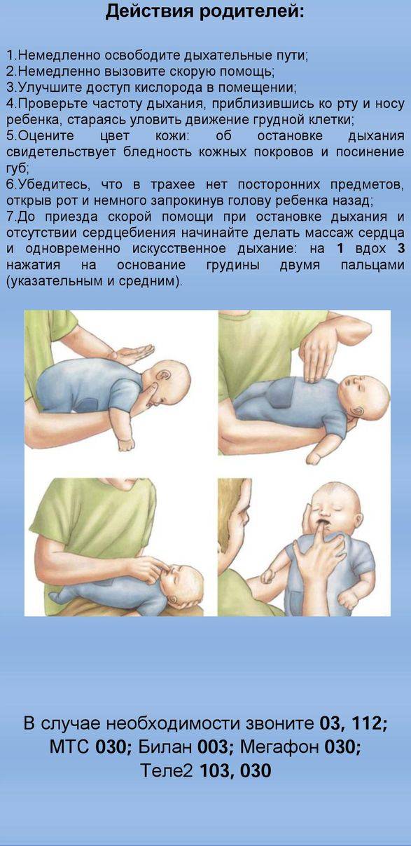 Ребенок подавился: что делать?