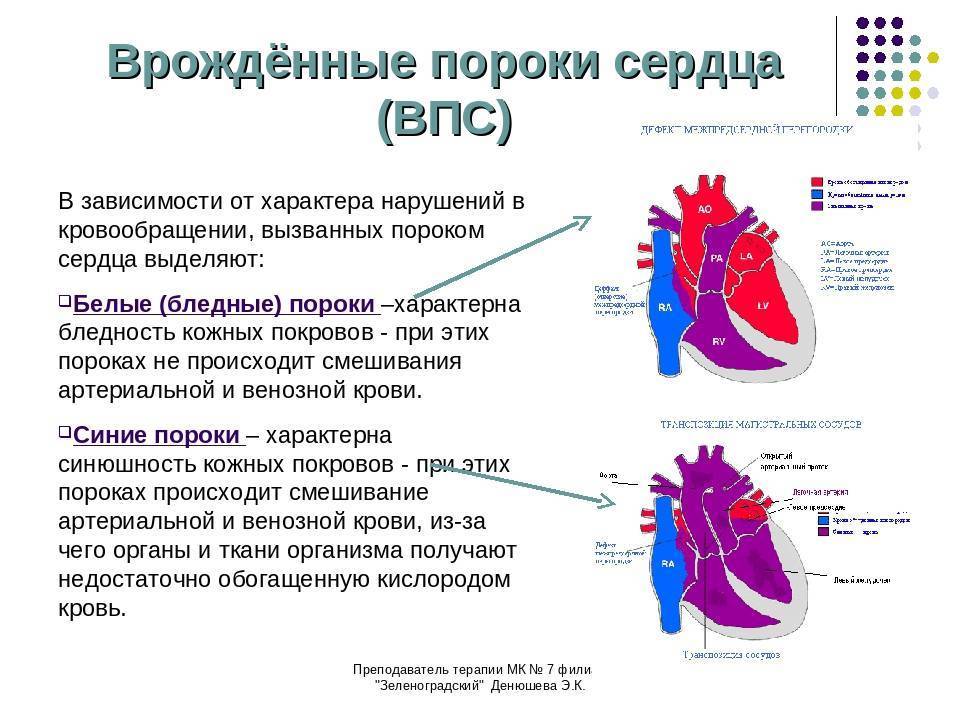 Порог сердца что это. Причины развития у детей врожденного порока сердца. Врожденные и приобретенные пороки сердца у детей. Врожденные клапанные пороки сердца. Наиболее распространенные пороки сердца.