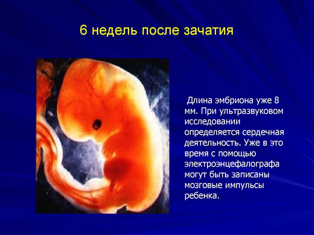 Плод 5 6 недель. Размер эмбриона в 6 недель акушерских. Плод 5-6 недели беременности размер плода. Эмбрион 5-6 недели беременности в животе. Плод на 5 недель 6 дней беременности эмбрион.