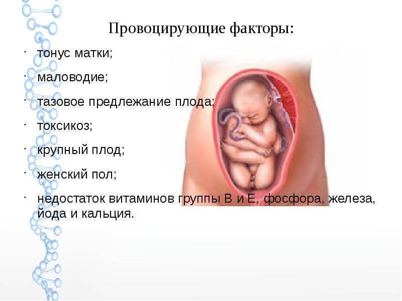 Смещение матки: причины и лечение | университетская клиника