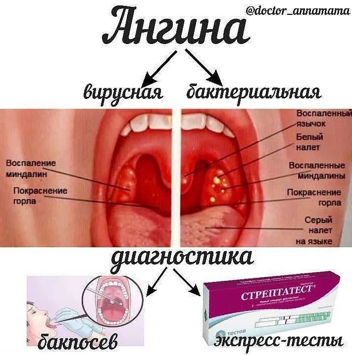 Что можно кормящим от горла. как правильно лечить горло при грудном вскармливании. методы лечения для кормящей мамы
