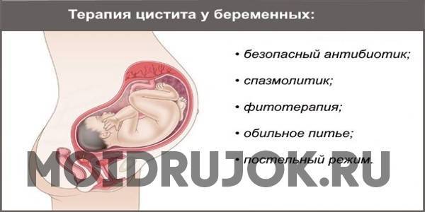 Цистит при беременности: диагностика и особенности лечения | канефрон® н