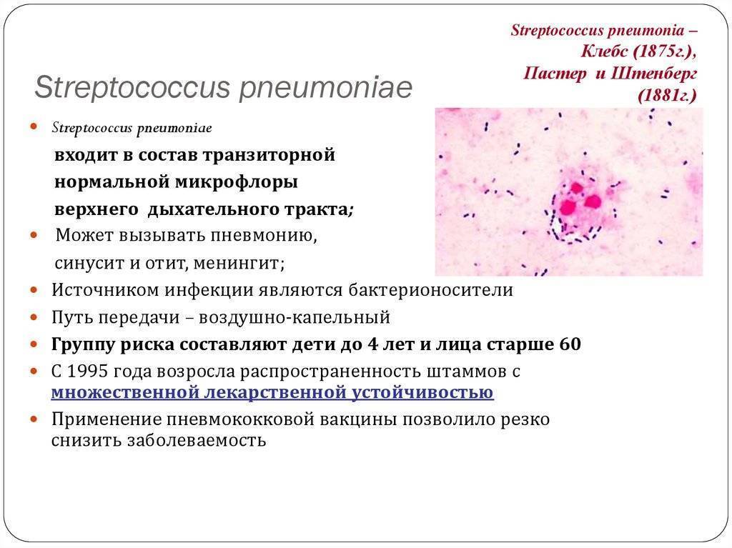 Стрептококковая инфекция
