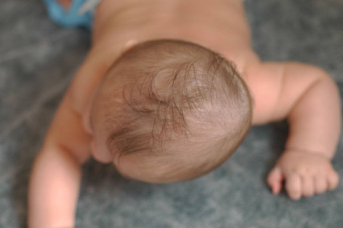 Почему у новорожденных вытянутая голова?