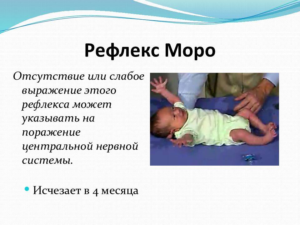 Таблица врожденных безусловных рефлексов новорожденных: видео и способы проверки