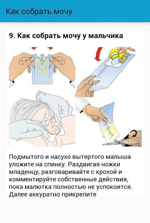 Как собрать мочу у грудничка: девочки и мальчика? чем собрать мочу у новорожденного? применение мочеприемника