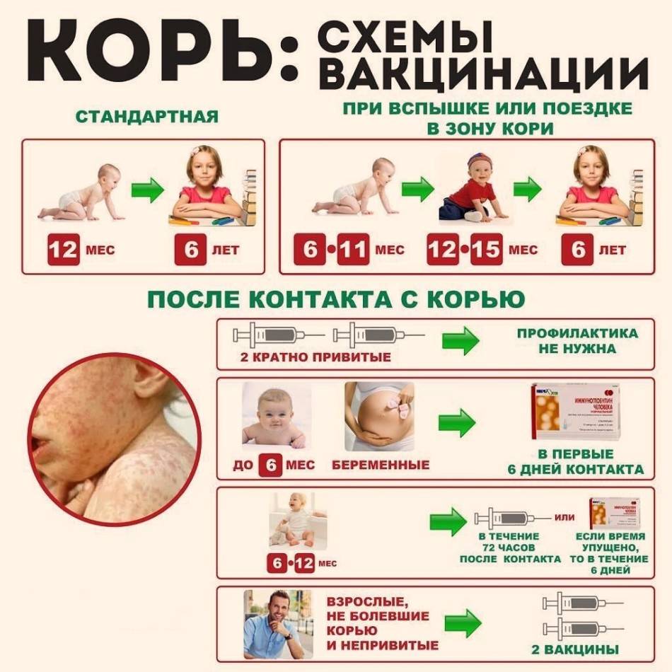 Корь | симптомы | диагностика | лечение - docdoc.ru
