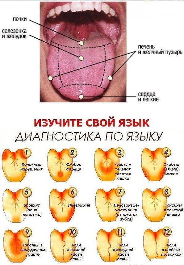 Почему у грудничков белый налет на языке у грудничка: причины, фото