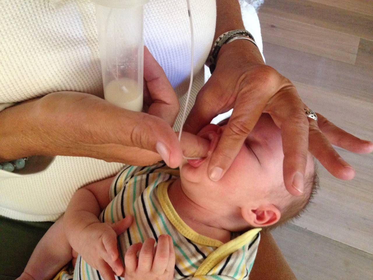 Короткая уздечка у малыша — патология, устраняемая за минуты