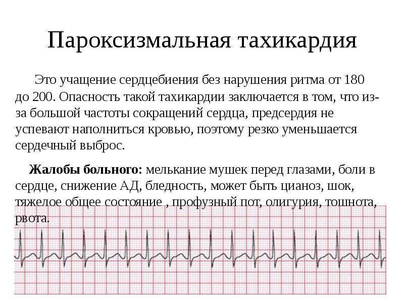 Тахикардия | симптомы | диагностика | лечение - docdoc.ru