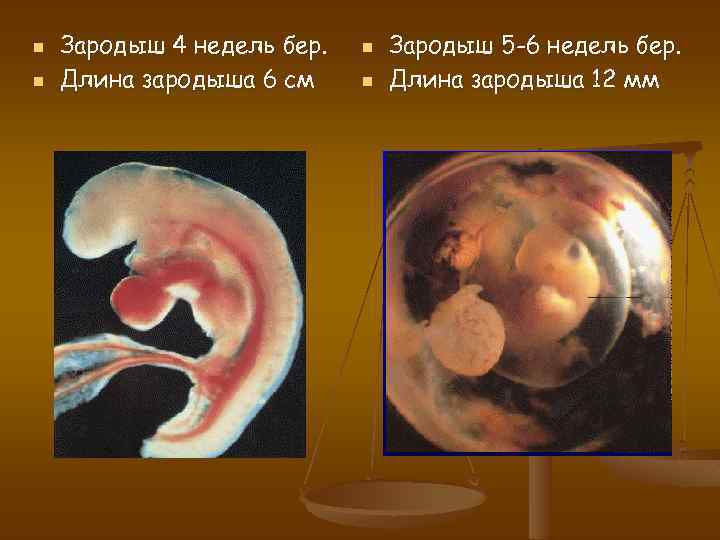 4 неделя беременности признаки, симптомы, что происходит с организмом