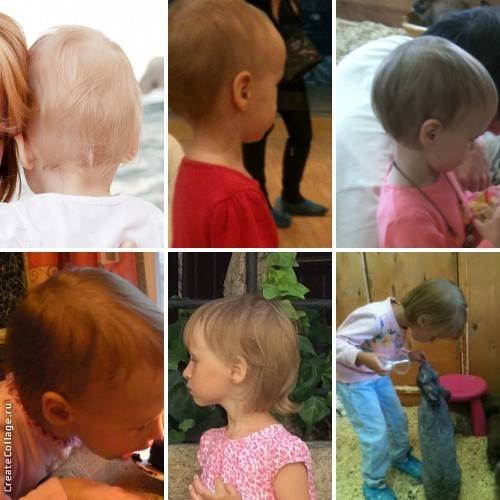Плохо растут волосы у ребёнка — 16 ответов врачей на вопрос на сайте спросиврача
