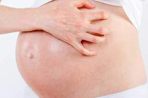 Почему у беременных чешется тело и как избавиться от зуда?