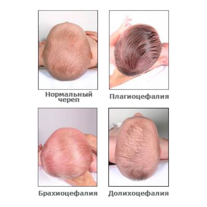 До какого возраста формируется череп у младенца