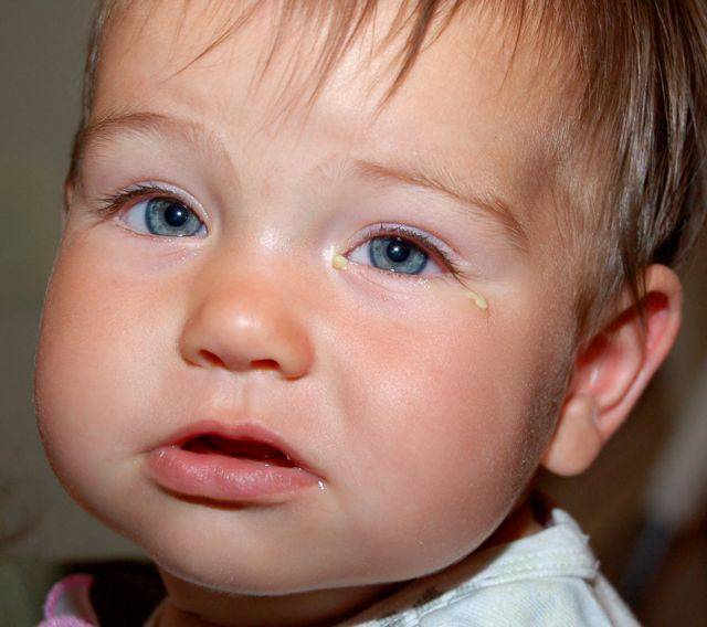 Гноится глаз у новорожденного: причины, правильная обработка в домашних условиях