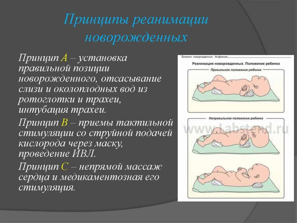 Реанимация новорожденного:оборудование, набор лекарств