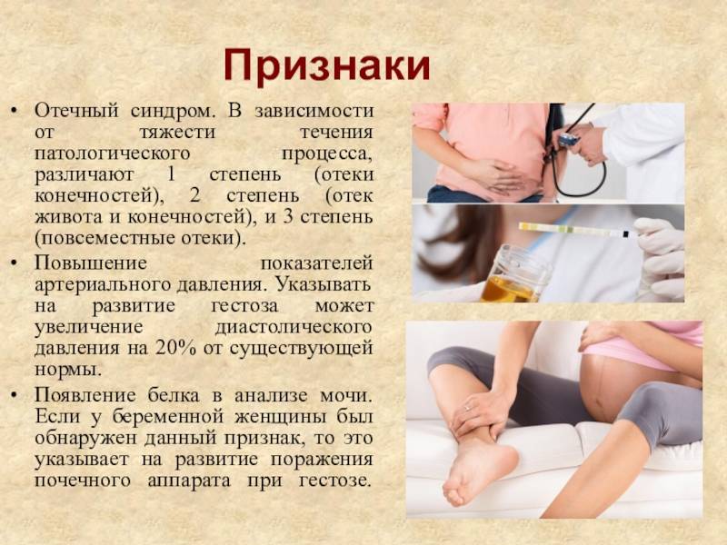 Гестоз | симптомы | диагностика | лечение - docdoc.ru