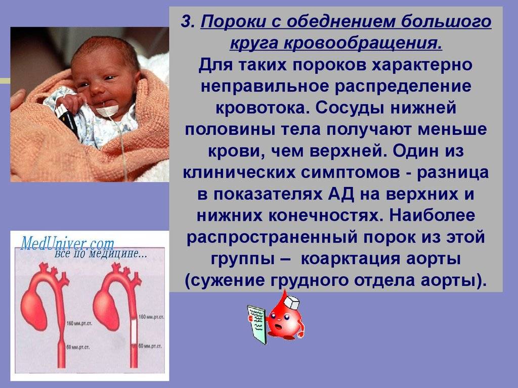 Впс у новорожденных: причины, симптомы и диагностика врожденного порока сердца
