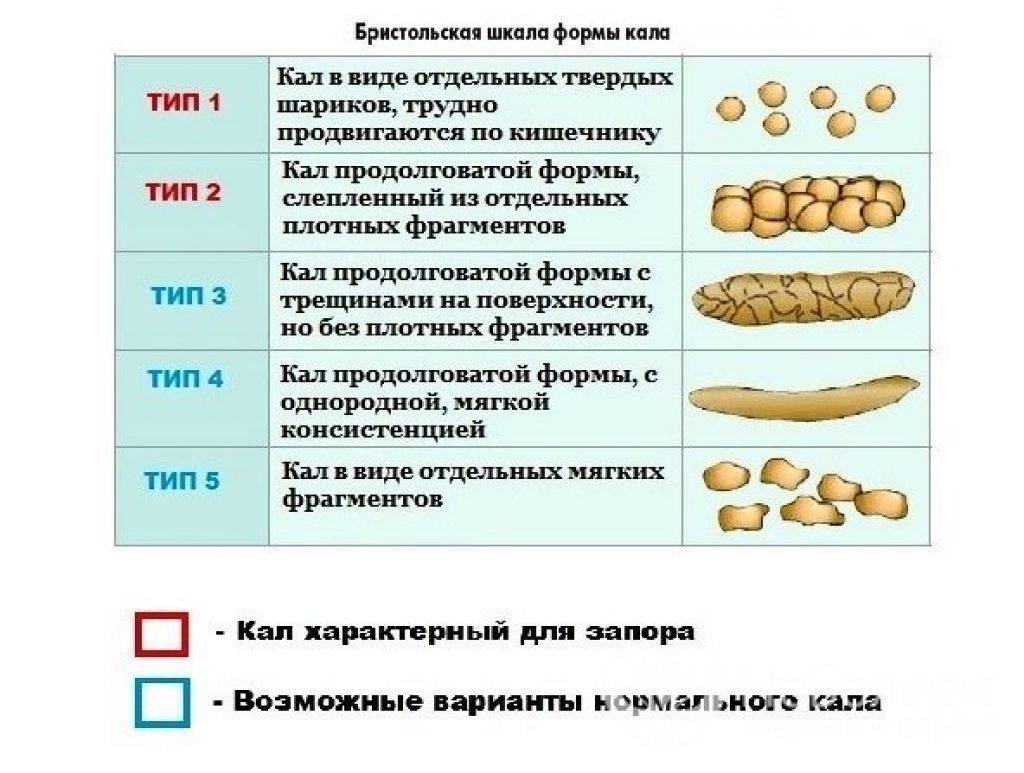 Запор у грудничка при грудном вскармливании: что делать