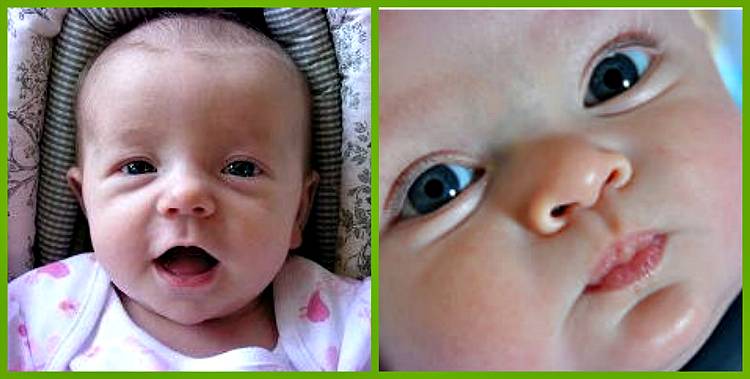 Опухшие глаза у новорожденного: в чем причины и что делать, если у грудничка отекло верхнее или нижнее веко?