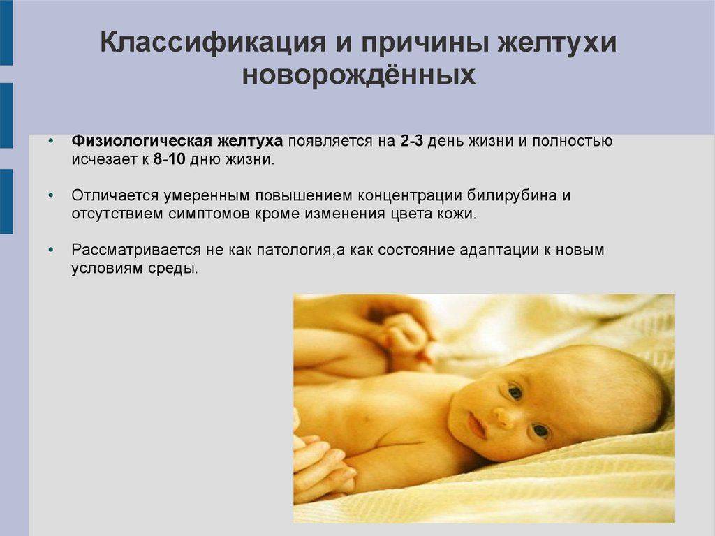Желтуха у новорожденных: причины, последствия, лечение и когда должна пройти?