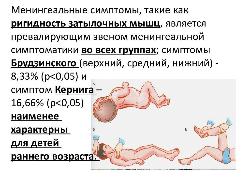 1 симптом менингита. Менингококковая инфекция симптом Кернига. Менингеальный симптом у грудничков до года. Менингит симптомы у детей 1 год.