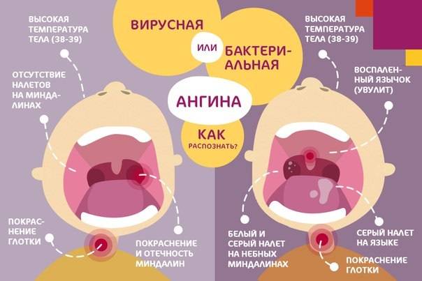 Что можно кормящим от горла. как правильно лечить горло при грудном вскармливании. методы лечения для кормящей мамы