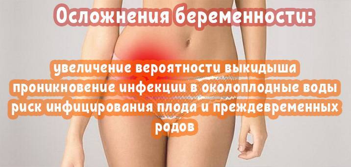 Кольпит: лечение, симптомы, признаки кольпита у женщин - рассказывает гинеколог — клиника «доктор рядом»