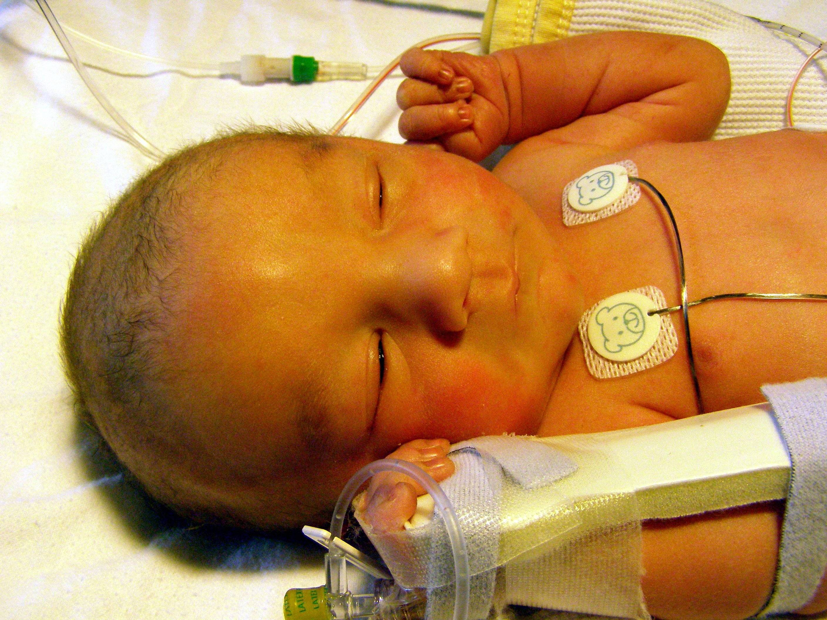 Послеродовая желтуха у новорожденных: особенности и лечение — медицинский центр «целитель»