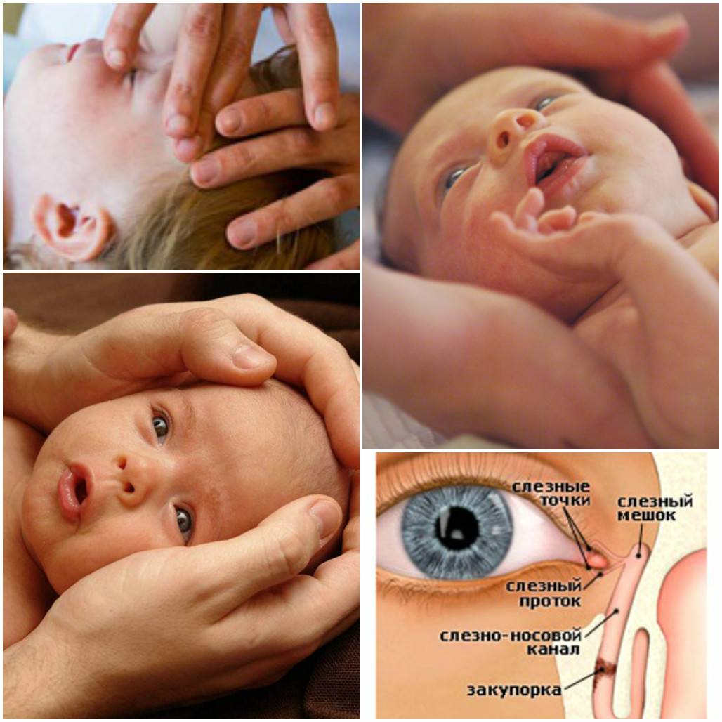 Массаж слезного канала у новорожденных: видео комаровского, как делать, средства для лечения глаз