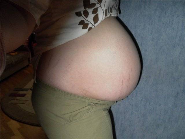 Почему чешется грудь при беременности, и как устранить проблему?