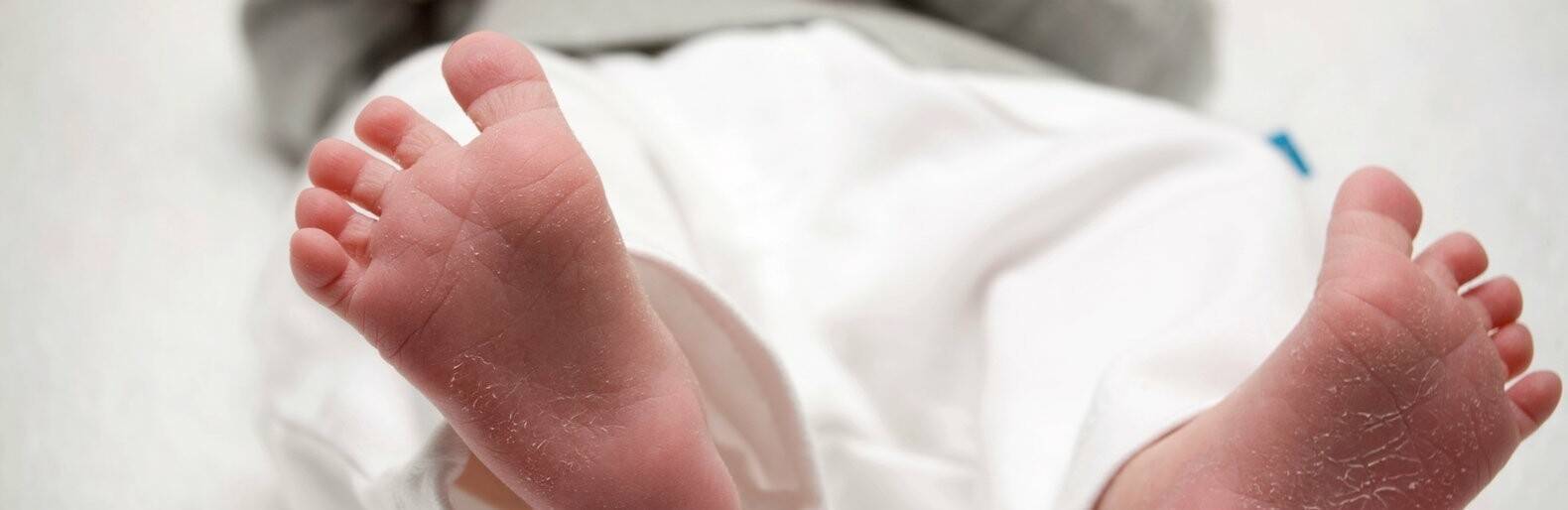 У ребенка облазит кожа на пальцах рук (ног): причины и что делать | ru-babyhealth